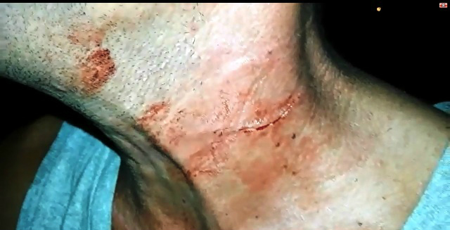 Nove horas depois de ser ferido com uma pá, homem é amarrado durante assalto Nove horas depois de ser ferido com uma pá, homem é amarrado durante assalto