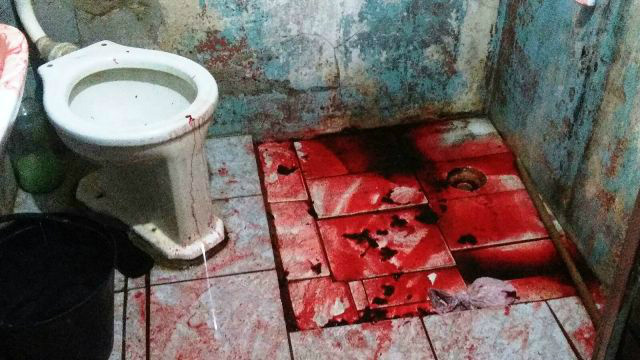 Idosa é encontrada gravemente ferida dentro do banheiro de residência