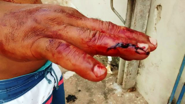Ao proteger a enteada, padrasto é agredido por jovem no bairro Vila Nova Ao proteger a enteada, padrasto é agredido por jovem no bairro Vila Nova