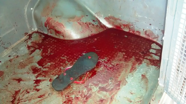 Pancadaria entre mulheres termina em sangue e delegacia Pancadaria entre mulheres termina em sangue e delegacia