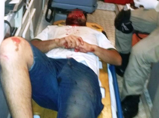 Vereador flagra acidente grave na Ranulpho Marques Leal 