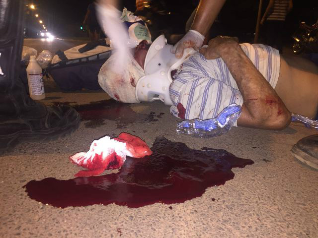 Ciclista é socorrido em estado grave após ser atingido por veículo 