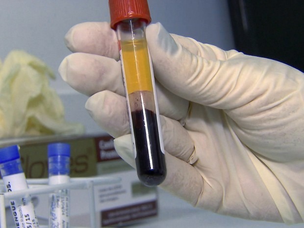 Saúde possui testes rápidos para diagnóstico da dengue Saúde possui testes rápidos para diagnóstico da dengue
