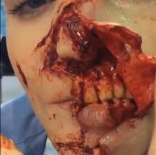 Jovem de 18 anos leva tiro no rosto durante briga com marido