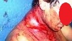 Cliente de bar no Santa Rita apanha e não sabe dizer quem é o acusado das agressões Cliente de bar no Santa Rita apanha e não sabe dizer quem é o acusado das agressões