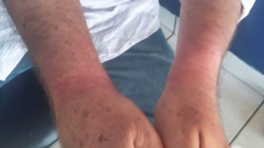 Grupo invade rancho, espanca caseiro e foge levando espingarda de pressão