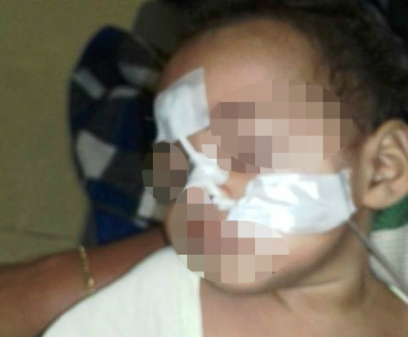Menina que nasceu com os dois sexos passa por cirurgia e luta pela sobrevivência Menina que nasceu com os dois sexos passa por cirurgia e luta pela sobrevivência